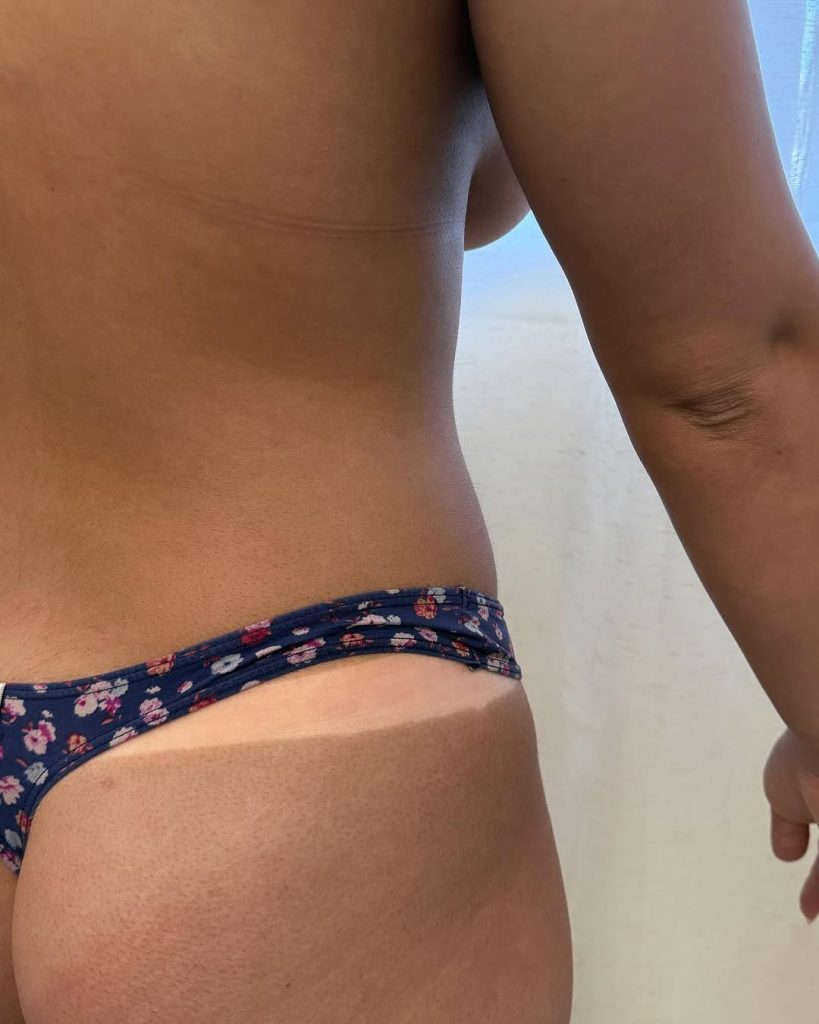 Spray Tan Newport Beach